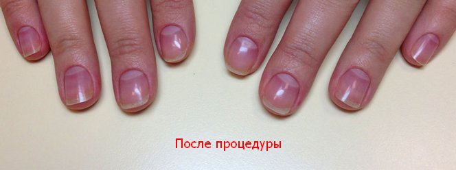 masura