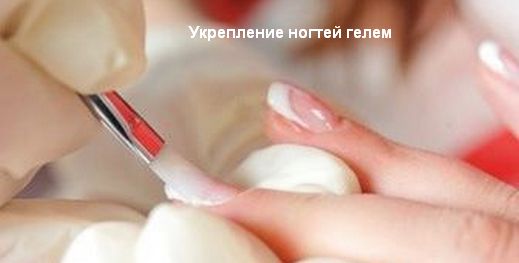 укрепление гелем